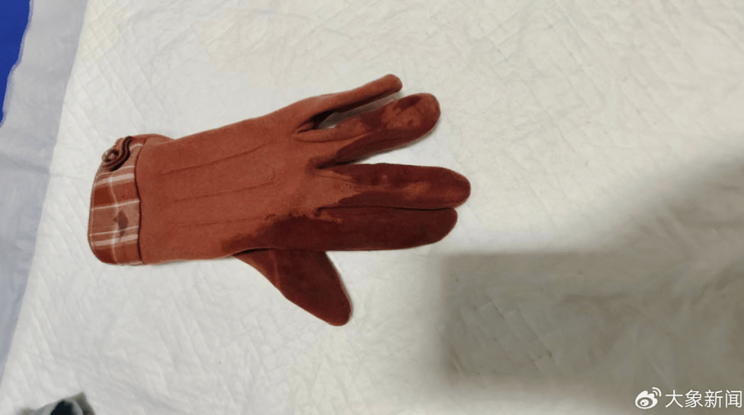 河南一男子街头挥刀乱刺，被休假女警一脚踢落凶器！女警面部缝合30余针，手套被血浸透